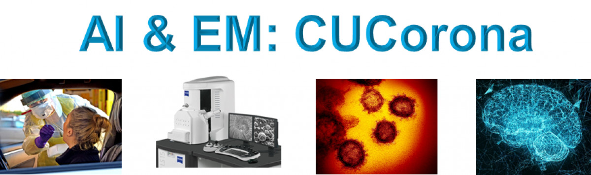 Searching for Dutch Electron Microscopy companies and researchers for rapid coronavirus diagnostics